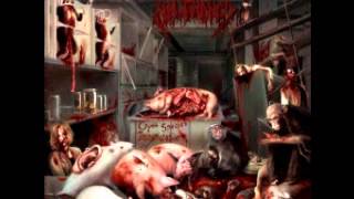 Watch Malignancy Congenital Decadence video