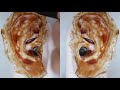 Asmr Ear Peeling Compilation Asmr Ear Peeling Compilation