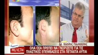 Ωτοπλαστική Στα Παιδιά - Star Channel - Dr. Med. B. Παυλιδέλης