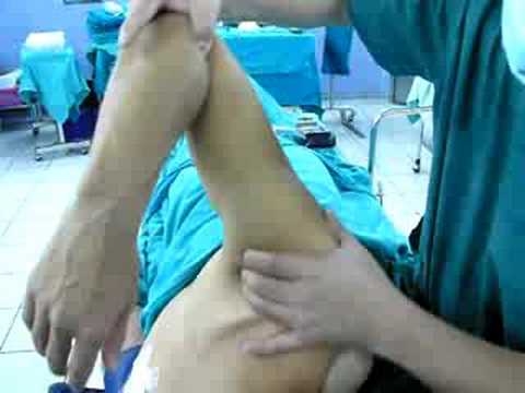 Dislocation Of Shoulder
