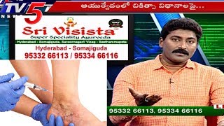 Varicose Veins Treatments | Sri Visista Hospitals | Health File | TV5 News