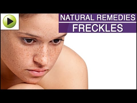 Skin Care - Freckles - Natural Ayurvedic Home Remedies