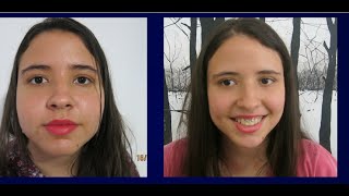 CRISTIANE MAZARINI - POLIMIOSITE (Parte 1)