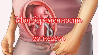 20 неделя беременности: фотография УЗИ и живота 20 неделя беременности: фотография УЗИ и живота