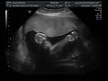 ultrasound 3d 4d