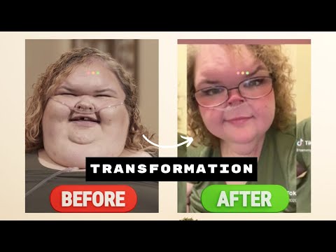 Tammy Slaton Flaunts SHOCKING Body Transformation Ahead Of Season 4 Release! (1000 Lb Sisters)