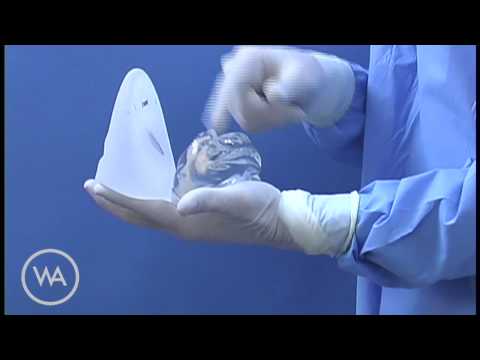 GEL BREAST IMPLANTS gel breast implants: