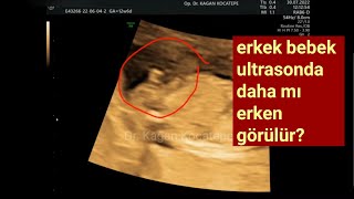 12 hafta 6 günlükken cinsiyetini gösteren bebek, erkek bebek cinsiyeti daha erken söylenebilir mi?