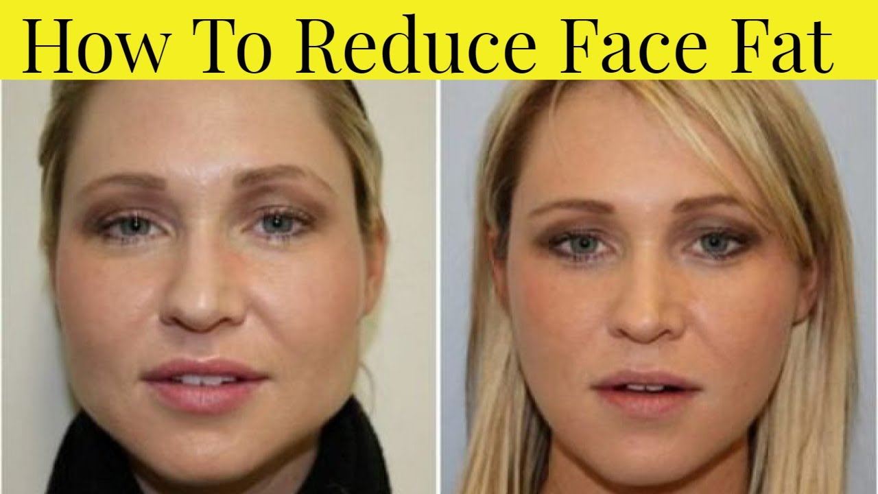 Reduce facial flushing