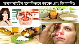 সাইনোসাইটিস হলে কিভাবে বুঝবেন এবং কি করনিও জানতে আমাদের ভিডিওটি দেখুন। Health Tips Ltd