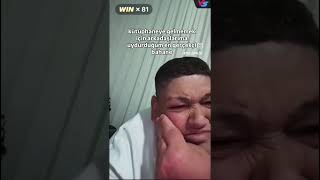 Hakan Yağar Arı Soktu Ya