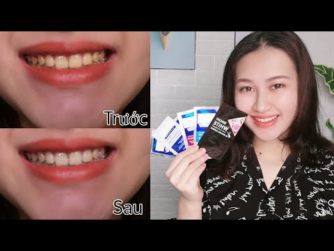 Miếng Dán Trắng Răng Trên Thị Trường Liệu Có An Toàn?!? | CHLOE DO