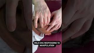 Patient Trying Manipulation For Mild Dns. For Appointments Call 8006738000