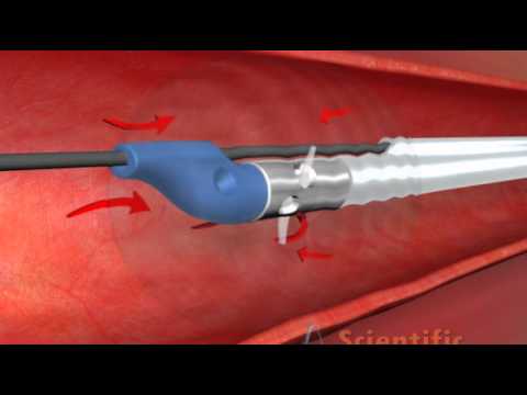 lourdes outpatient dialysis