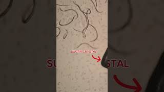 Sugar Vs Parasites Under The Microscope