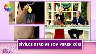 Prof. Dr. İbrahim Saraçoğlundan Sivilceler Için Doğal Ve Kesin Öneriler