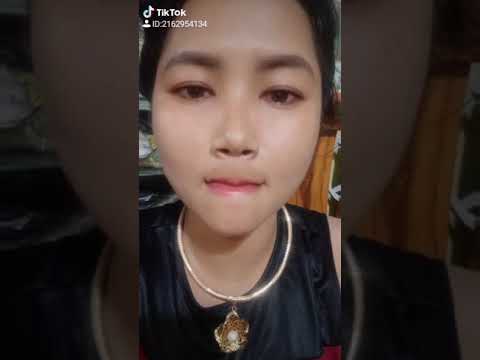 Hậu quả bơm môi quá đà(2)
