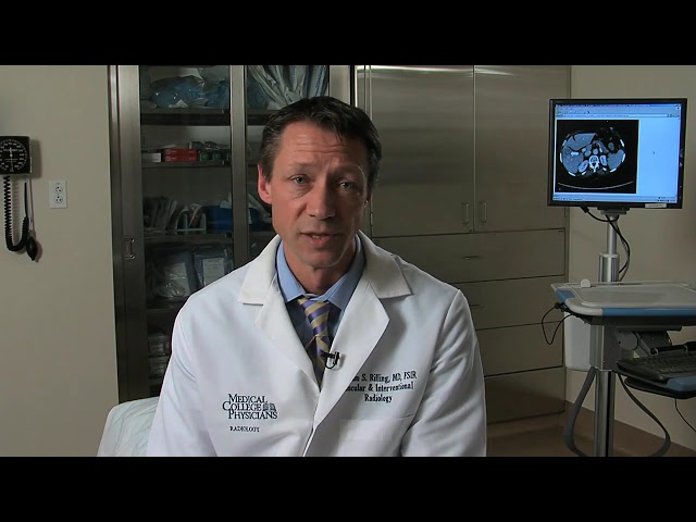 Watch What symptoms occur after a liver ablation procedure? (William Rilling, MD, FSIR) on YouTube.