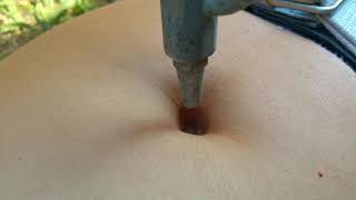 New Deep Hole Bellyon Challenge