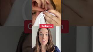 Chalazion Eyelid Cyst