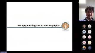 Acute Stroke Imaging