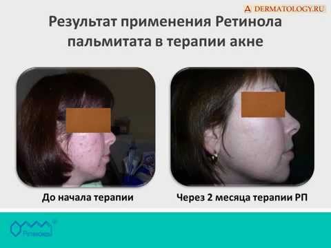 Диагностика заболеваний по лицу Детское творчество - аппликации, поделки из цветной бумаги