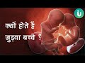 जुड़वा बच्चे क्यों, कैसे और कब पैदा होते हैं, 3D में देखें - Twins pregnancy in hindi by Dr. Archana