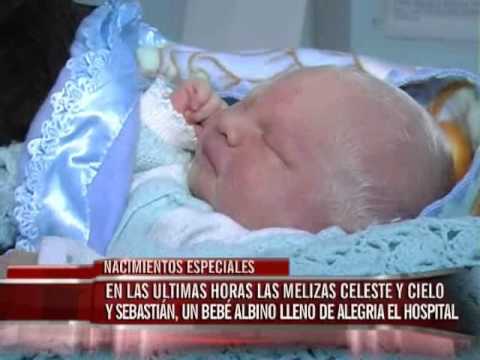 La crema que blanquea miracle glow con la raíz china korditsepsom