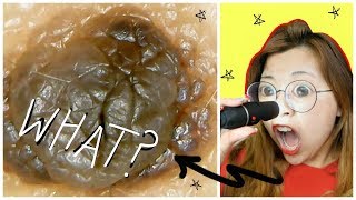 EWW! Acne + Pores Under a MICROSCOPE! (very graphic)