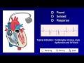 Pacemaker Modes and Settings