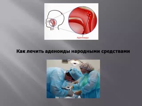 Бензопила макита ремонт своими руками Бензопила макита ремонт своими руками