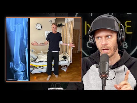 Tony Hawk Broke His Femur. Was Walking The Next Day!