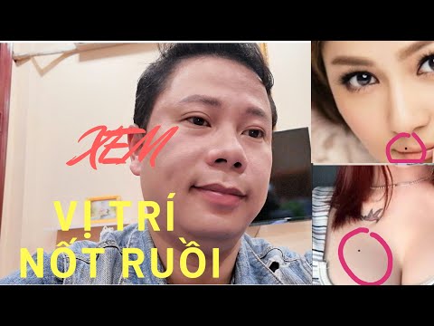 Xem những nốt ruồi quý, đừng dại mà tẩy xóa | Tử vi tướng số 2020