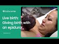 Live birth: Epidural