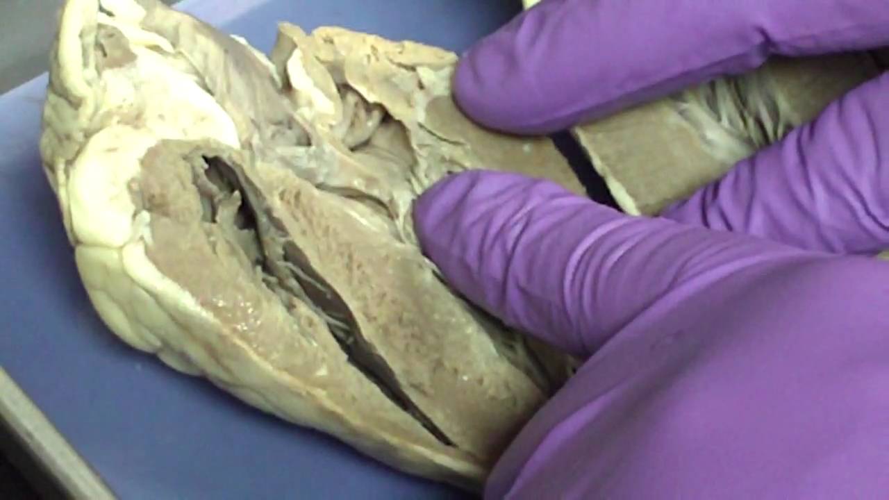 Heart anatomy, pericardium, myocardium, epicardium - YouTube