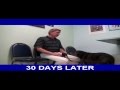Watch Stem Cell Therapy for Pets - Guiness Before & After Video