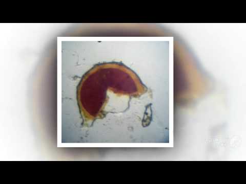 Header of Acaulospora