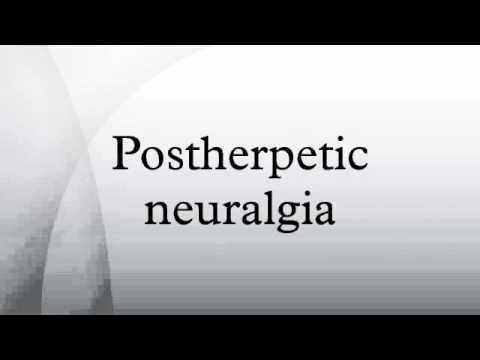 gabapentin bei zoster neuralgie