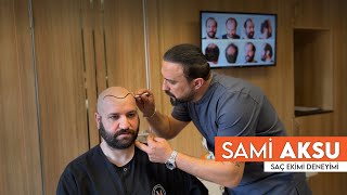 Sami Aksu Saç Ekimi Deneyimi I 10.Gün Kabuk Dökümü I Murat Makascı Saç Ekim Merkezi