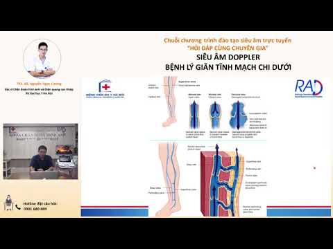 Siêu âm Doppler bệnh lý giãn tĩnh mạch chi dưới | ThS.BS. Nguyễn Ngọc Cương