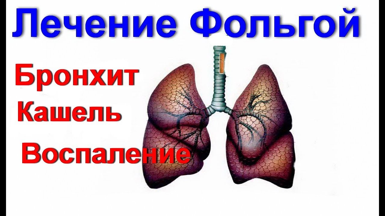 Бронхит чем лечить в домашних условиях 585