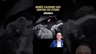 Bebês Fazendo Xixi Dentro Do Útero