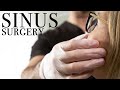 How To Fix Chronic Sinus Infections | Plastic Surgeon | Dr. Moustafa Mourad