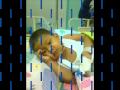 bojie biliary atresia