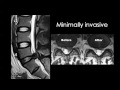 Post operative spine imaging   Prof Dr  Mamdouh Mahfouz In Arabic 720p