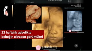 23 haftalık gebelikte bebeğin yüzünün ultrason görüntüleri