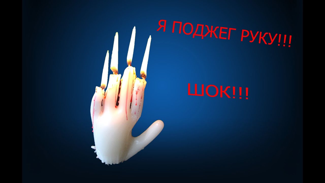 Как сделать так что бы рука отекла Как сделать так что бы рука отекла