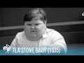 En 1935, este era el niño de tres años más obeso del mundo