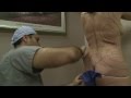 La chirurgie des fesses, nouvelle mode en Californie