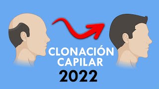 CLONACION de PELO explicado por MEDICO ¿Disponible 2022?